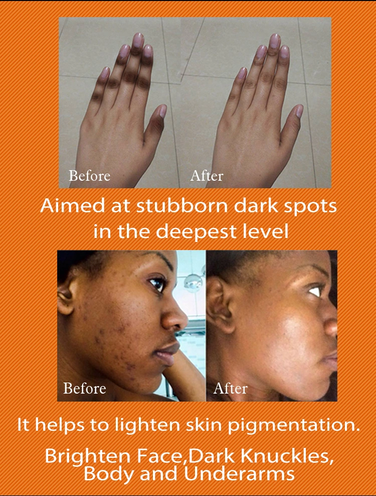 Private Label Ailke Apha Arbutin 4% Pearl Bright 7 Days Dark Spot Corrector Face Stronger Skin Whitening Cream